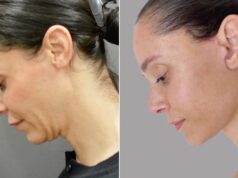Di Dalam Bangkitnya Facelift 40-an
| beritakitanih Di Dalam Bangkitnya Facelift 40-an
| beritakitanih