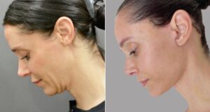 Di Dalam Bangkitnya Facelift 40-an
| beritakitanih Di Dalam Bangkitnya Facelift 40-an
| beritakitanih