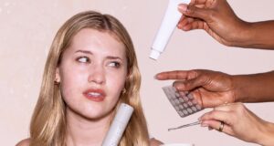 Isotretinoin, Tapi Jadikan Topikal: Alternatif Accutane Ini Membuat Perawatan Jerawat Lebih Mudah Diakses
| beritakitanih Isotretinoin, Tapi Jadikan Topikal: Alternatif Accutane Ini Membuat Perawatan Jerawat Lebih Mudah Diakses
| beritakitanih