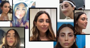 Saya Mendapat Revisi Operasi Hidung untuk Memperbaiki Operasi Hidung Saya—Foto Sebelum & Sesudah
| beritakitanih Saya Mendapat Revisi Operasi Hidung untuk Memperbaiki Operasi Hidung Saya—Foto Sebelum & Sesudah
| beritakitanih