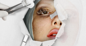 Saya Menghabiskan Seminggu Sebagai Perawat Facelift Teman Saya. Inilah Yang Tidak Diberitahukan Siapa Pun kepada Anda.
| beritakitanih Saya Menghabiskan Seminggu Sebagai Perawat Facelift Teman Saya. Inilah Yang Tidak Diberitahukan Siapa Pun kepada Anda.
| beritakitanih