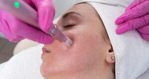 Amankah Mendapatkan Microneedling di Musim Panas? Kami Bertanya pada Ahlinya
| beritakitanih Amankah Mendapatkan Microneedling di Musim Panas? Kami Bertanya pada Ahlinya
| beritakitanih