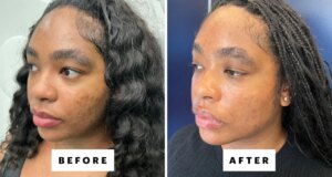 Apakah Laser Genesis Benar-Benar Memenuhi Hype?
| beritakitanih Apakah Laser Genesis Benar-Benar Memenuhi Hype?
| beritakitanih