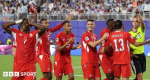 Embolo dikeluarkan dari lapangan karena kesalahan aturan identitas
| beritakitanih Embolo dikeluarkan dari lapangan karena kesalahan aturan identitas
| beritakitanih
