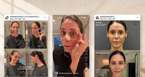 Facelift Bukan Lagi Sekadar Prosedur di kemudian hari
| beritakitanih Facelift Bukan Lagi Sekadar Prosedur di kemudian hari
| beritakitanih