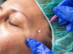 Haruskah Anda Melakukan Thread Lift? Debat Dokter
| beritakitanih Haruskah Anda Melakukan Thread Lift? Debat Dokter
| beritakitanih
