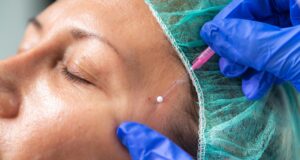 Haruskah Anda Melakukan Thread Lift? Debat Dokter
| beritakitanih Haruskah Anda Melakukan Thread Lift? Debat Dokter
| beritakitanih
